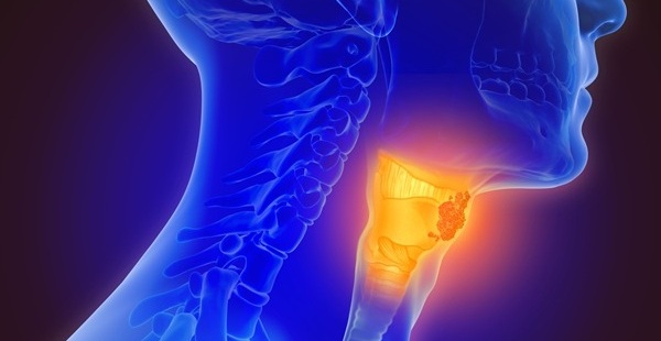 Imagen: el líquido linfático posquirúrgico es una poderosa fuente de ADNtc para la detección temprana de recurrencia en el cáncer de cabeza y cuello (fotografía cortesía de Adobe Stock)
